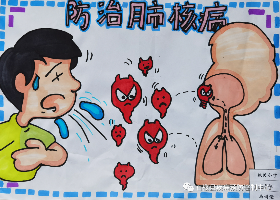 关于二年级的肺结核的画画图片