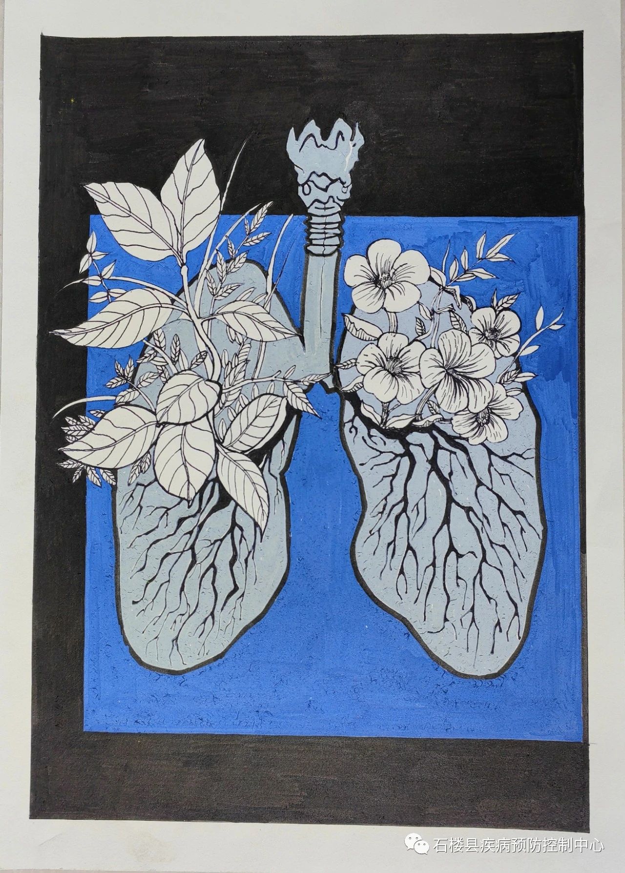 “预防结核疾病 共绘健康生活”创意绘画作品